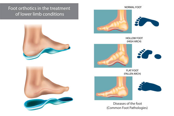 foot orthotics